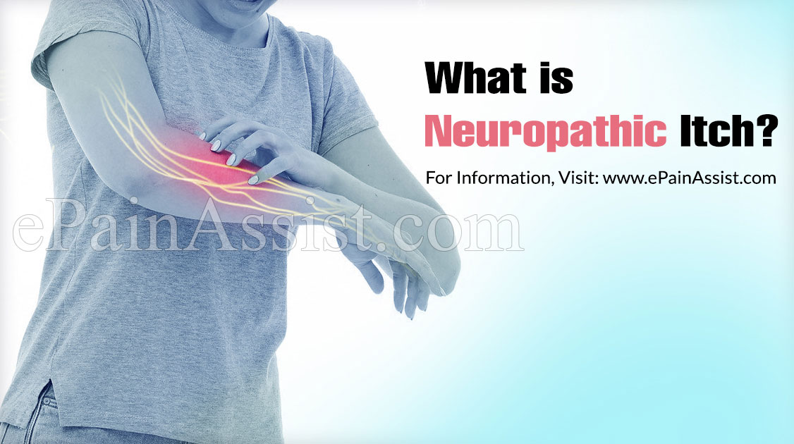 What is Neuropathic Itch?