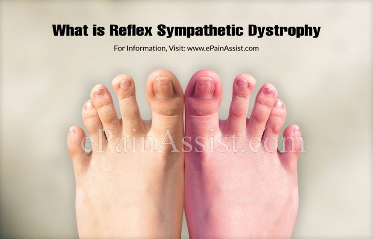 What is Reflex Sympathetic Dystrophy & What is its Prognosis? | Causes, Symptoms, Treatment of RSD