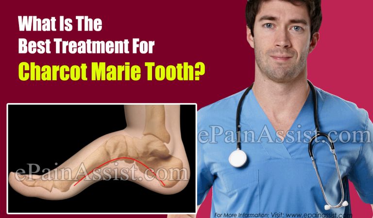 What Is The Best Treatment For Charcot Marie Tooth?