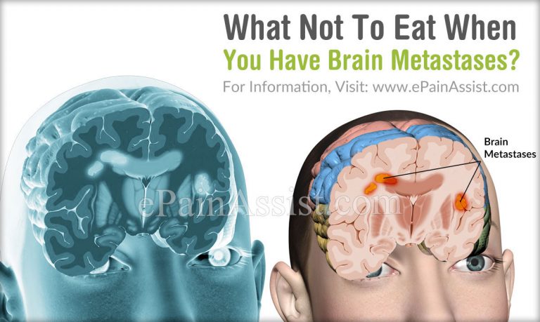 What Not To Eat When You Have Brain Metastases?