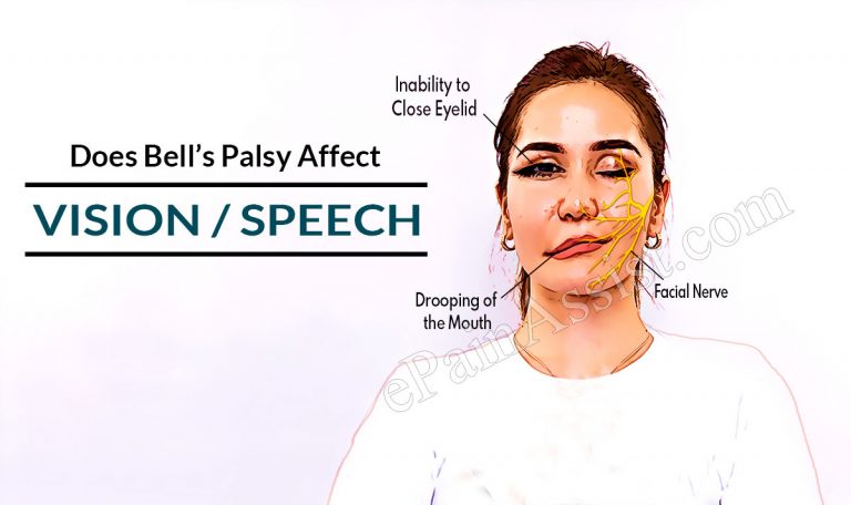 Does Bell’s Palsy Affect Vision/Speech & How Much B12 Should I Take For It?