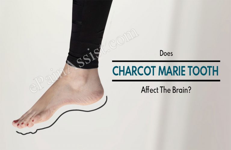 Does Charcot Marie Tooth Affect The Brain & What About The Heart?