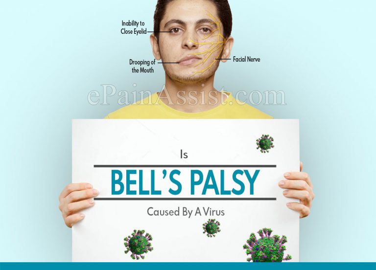 Is Bell’s Palsy Caused By A Virus & Why Is It So Painful?