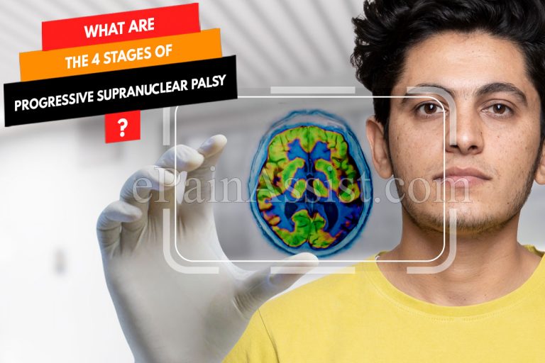 What Are The 4 Stages Of Progressive Supranuclear Palsy?