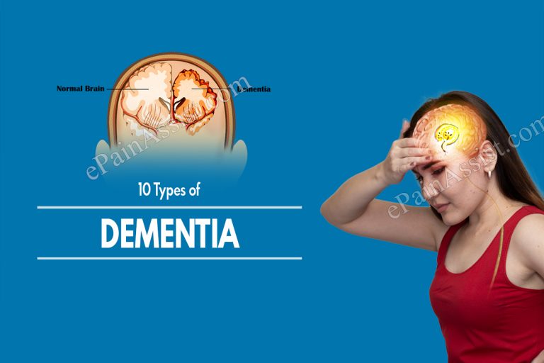 10 Types of Dementia