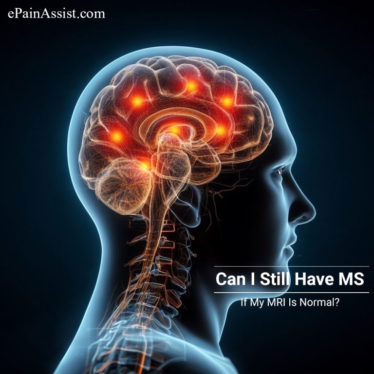 Can I Still Have MS If My MRI Is Normal?