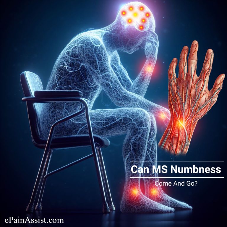 Can MS Numbness Come And Go?