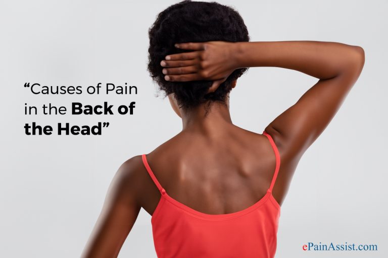 Causes of Pain in the Back of the Head