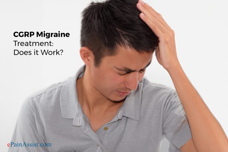 CGRP Migraine Treatment: Does it Work?