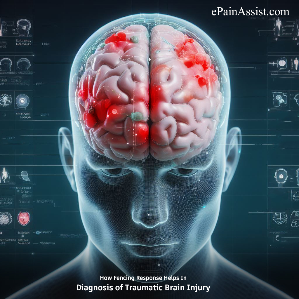 How Fencing Response Helps In Diagnosis of Traumatic Brain Injury