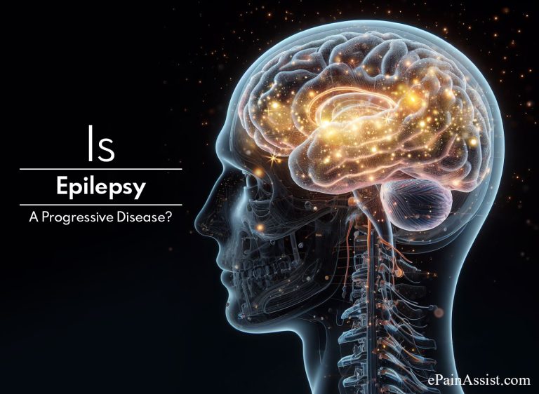 Is Epilepsy A Progressive Disease?