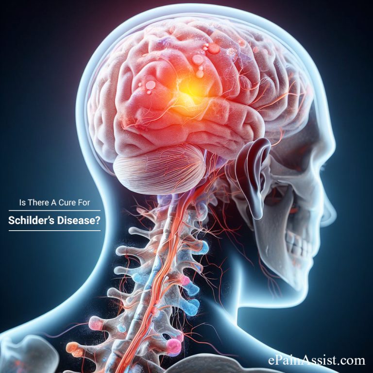 Is There A Cure For Schilder’s Disease?