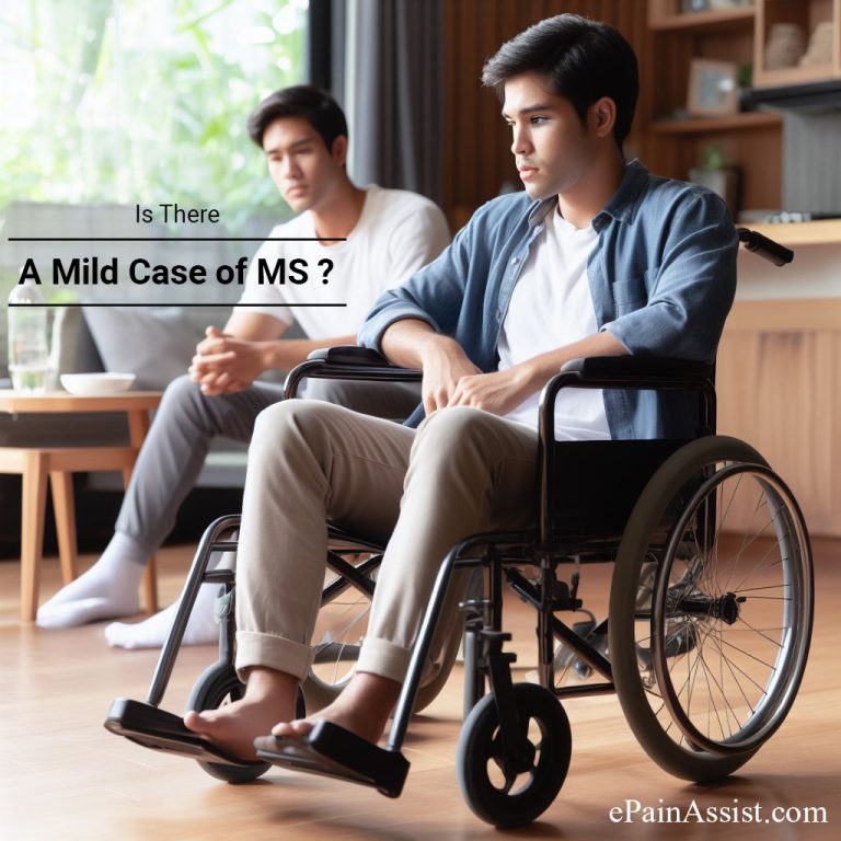 Is There A Mild Case Of MS?