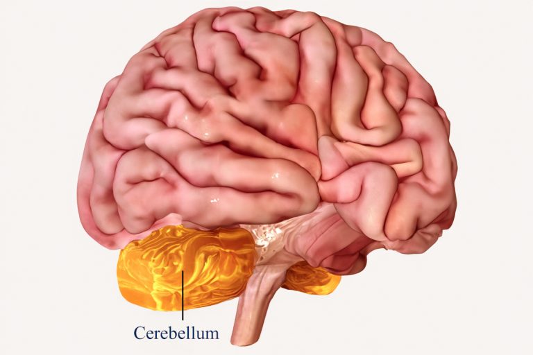 Recovery and Rehabilitation Strategies for Acute Cerebellar Ataxia : A Comprehensive Guide