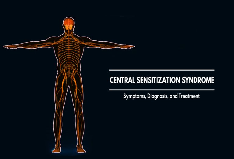 Understanding Central Sensitization Syndrome : Symptoms, Diagnosis, and Treatment