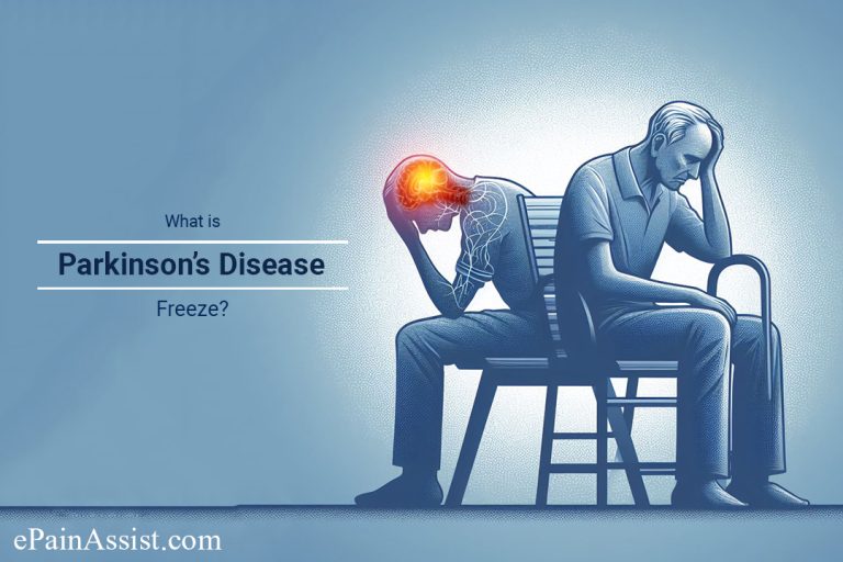 What is a Parkinson’s Disease Freeze?