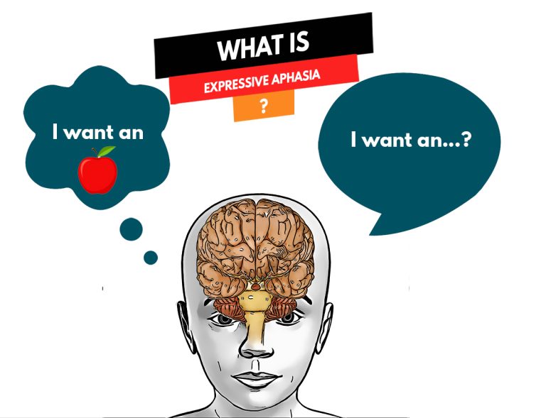Understanding Expressive Aphasia: Causes, Symptoms, and Treatment