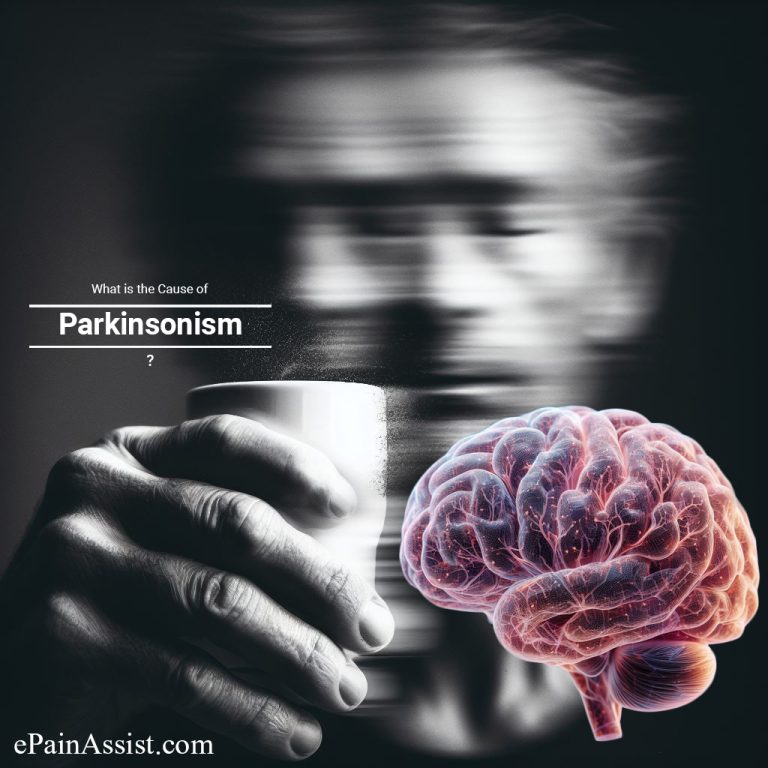 What is the Cause of Parkinsonism?