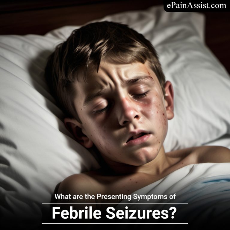 What are the Presenting Symptoms of Febrile Seizures?
