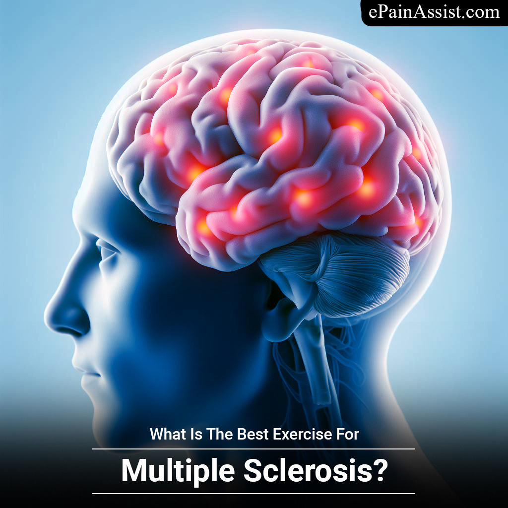 What Is The Best Exercise For Multiple Sclerosis?