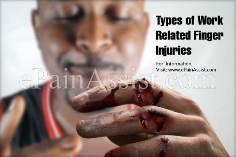Types of Work Related Finger Injuries & How An Employee Can Deal With The Finger Injury At The Workplace?