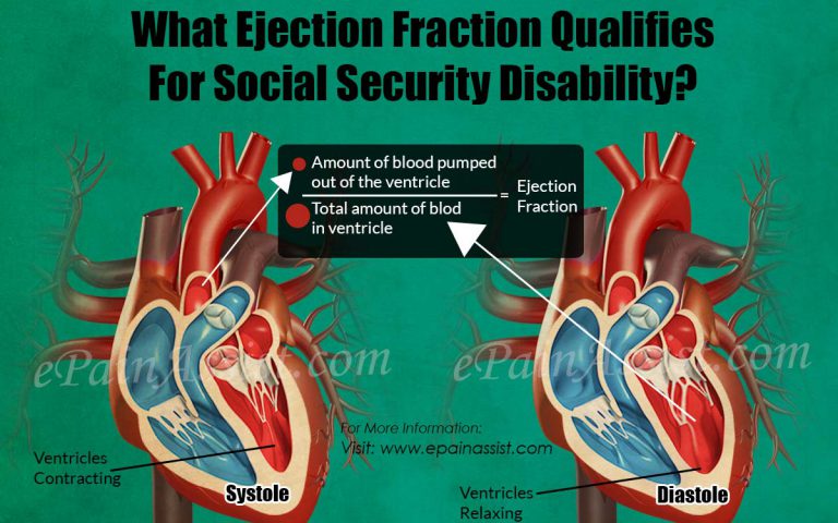 What Ejection Fraction Qualifies For Social Security Disability?