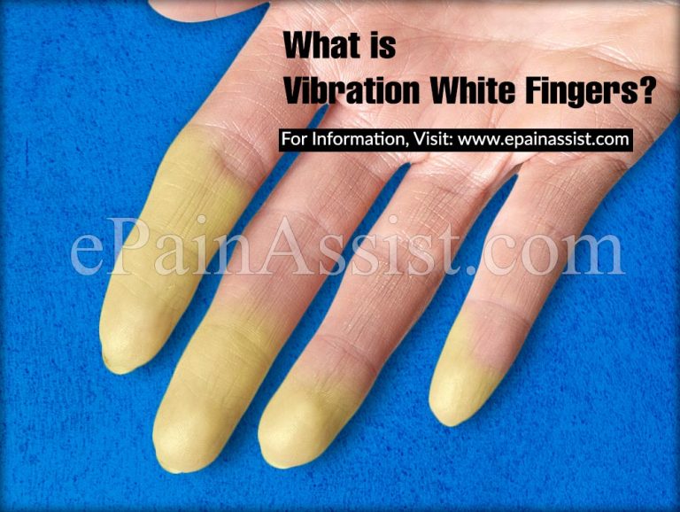 Vibration White Fingers: Causes, Symptoms, Treatment, Claims, Prevention