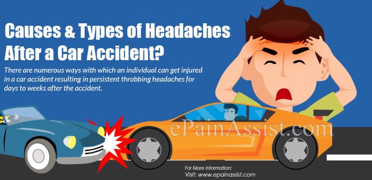 Causes & Types of Headaches After a Car Accident?
