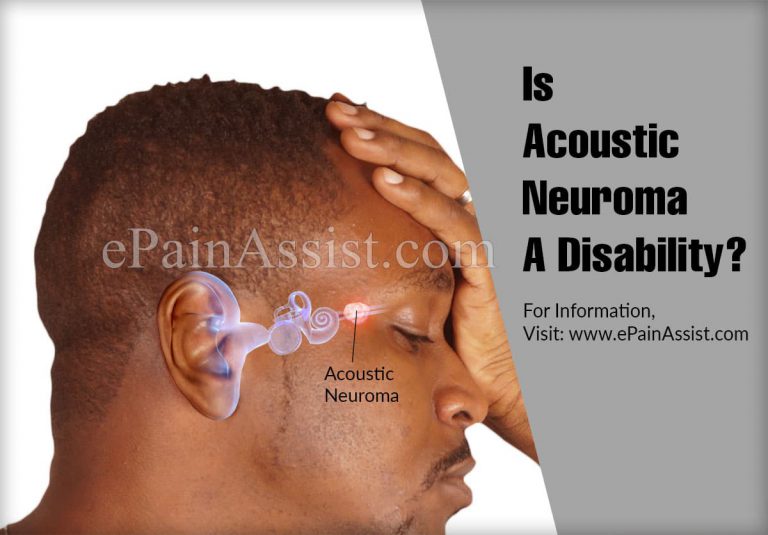 Is Acoustic Neuroma A Disability?