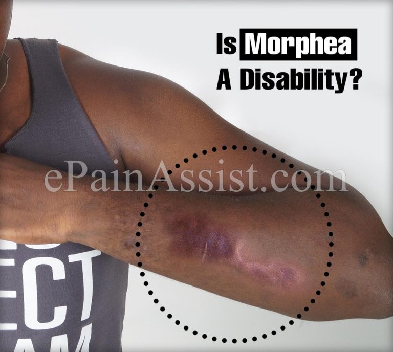 Is Morphea A Disability?