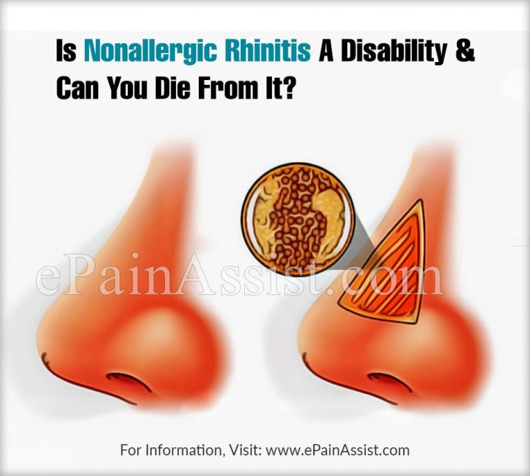 Is Nonallergic Rhinitis A Disability & Can You Die From It?