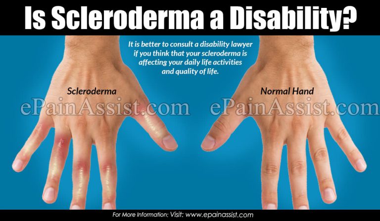 Is Scleroderma a Disability?