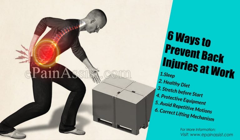 6 Ways to Prevent Back Injuries at Work