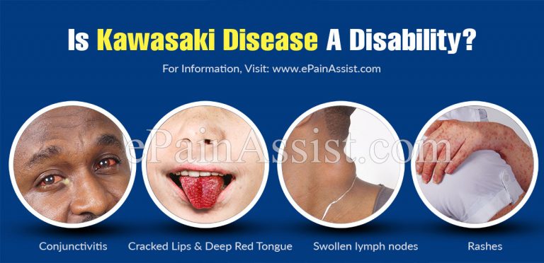 Is Kawasaki Disease A Disability?