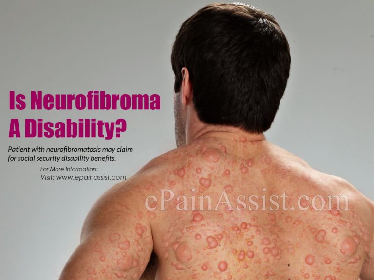 Is Neurofibroma A Disability?