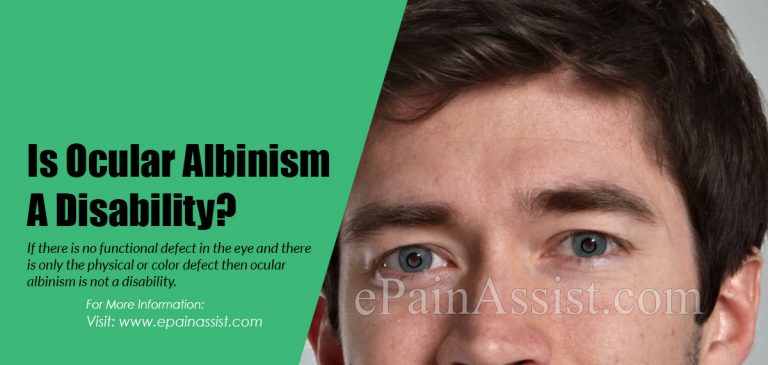 Is Ocular Albinism A Disability?