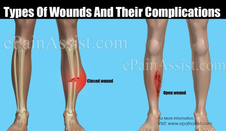 Types Of Wounds And Their Complications