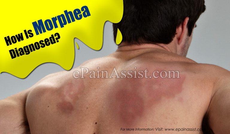 How Is Morphea Diagnosed?