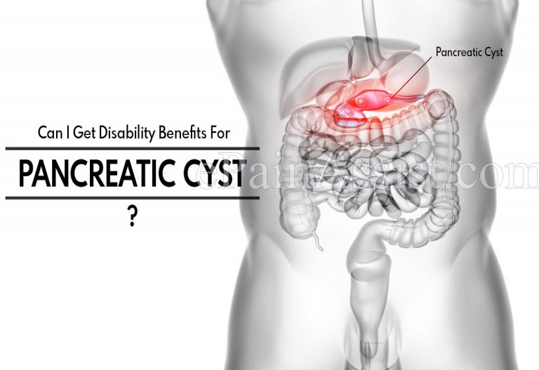 Can I Get Disability Benefits For Pancreatic Cyst & Can You Die From It?