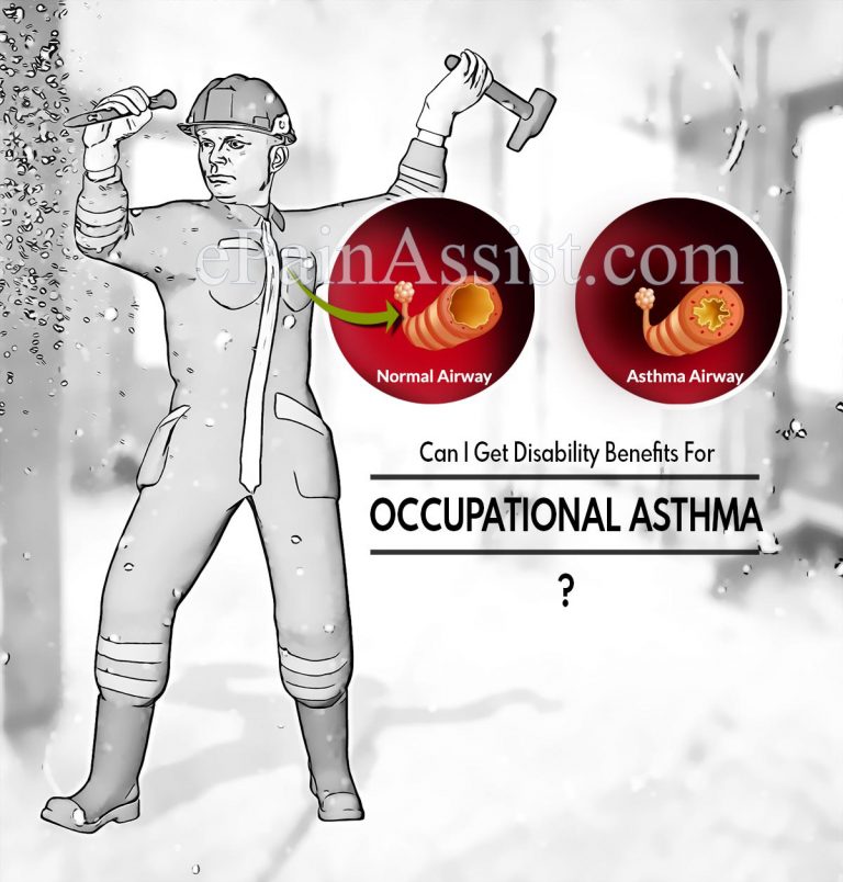 Can I Get Disability For Occupational Asthma & How Much Can I Get?