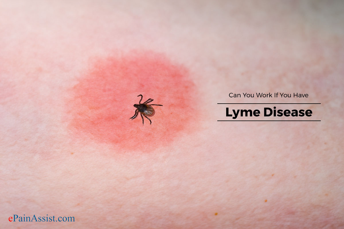 Can You Work If You Have Lyme Disease?