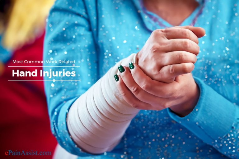 Most Common Work Related Hand Injuries