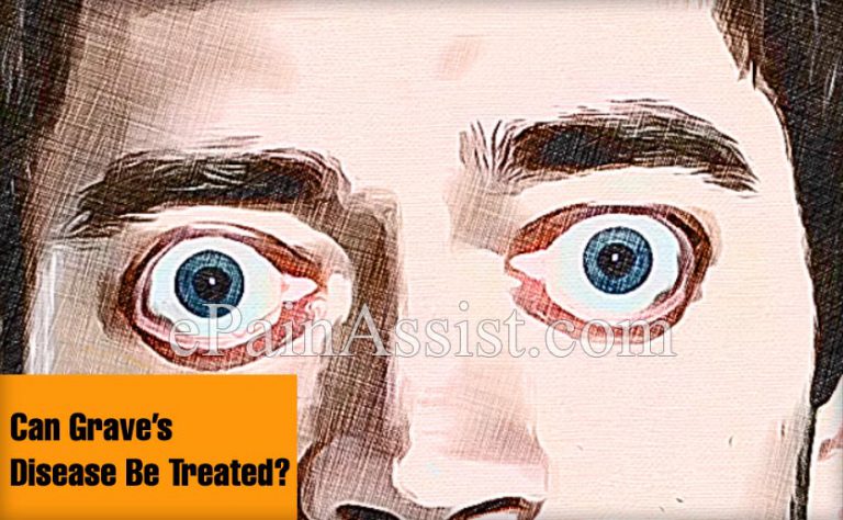 Can Grave’s Disease Be Treated?