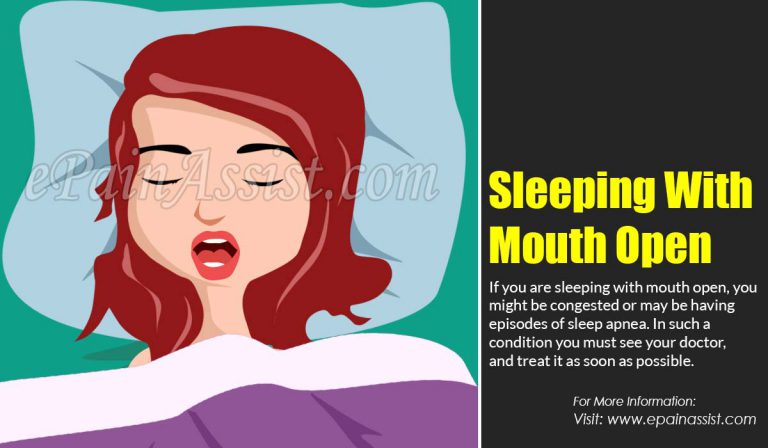Sleeping With Mouth Open: Causes, Symptoms, Treatments, Side Effects