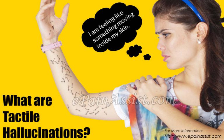 What is a Tactile Hallucinations: Symptoms, Treatment, 11 Causes of Tactile Hallucinations