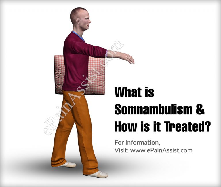 What is Somnambulism  & How is it Treated?|Causes, Symptoms, Diagnosis of Somnambulism