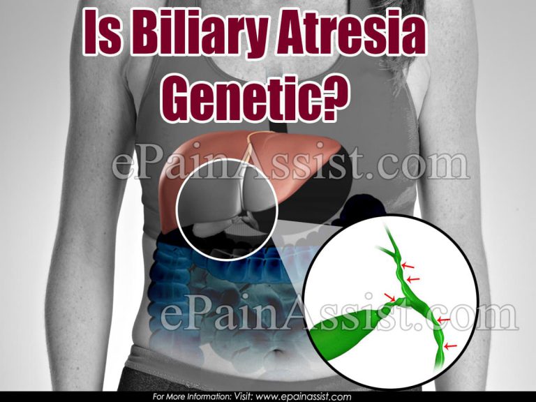 Is Biliary Atresia Genetic?