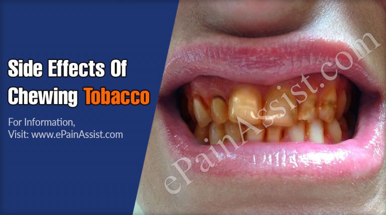 Side Effects Of Chewing Tobacco & Treatments To Quit Chewing Tobacco