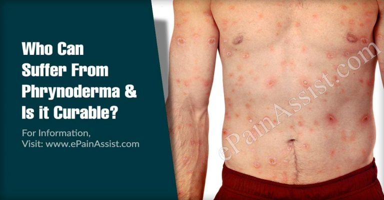Who Can Suffer From Phrynoderma & Is it Curable?