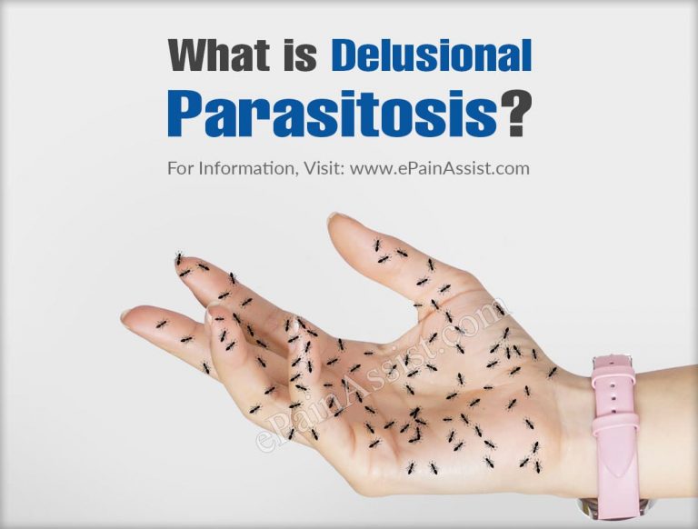 Delusional Parasitosis: Types, Causes, Symptoms, Treatment, Diagnosis